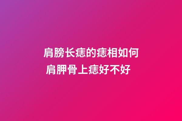 肩膀长痣的痣相如何 肩胛骨上痣好不好